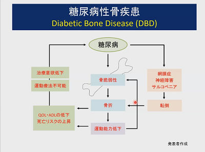 糖尿病性骨疾患　Diabetic Bone Diease(DBD)
